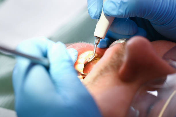 Best Broken or Cracked Tooth Emergency Dentist in Green, OR