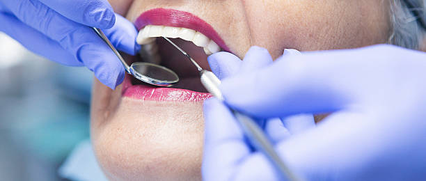 Best Emergency Dental Extractions in Green, OR